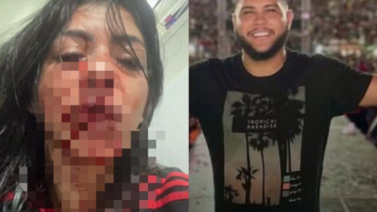 Mulher exibe lesões após agressão, enquanto agressor se entrega à polícia. Reprodução: iG.