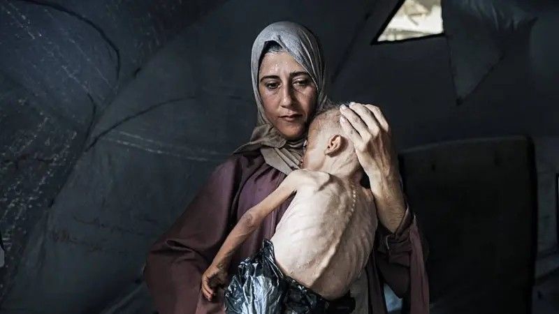 Crianças em Gaza enfrentam desnutrição e fome durante a crise humanitária. Reprodução: Globo