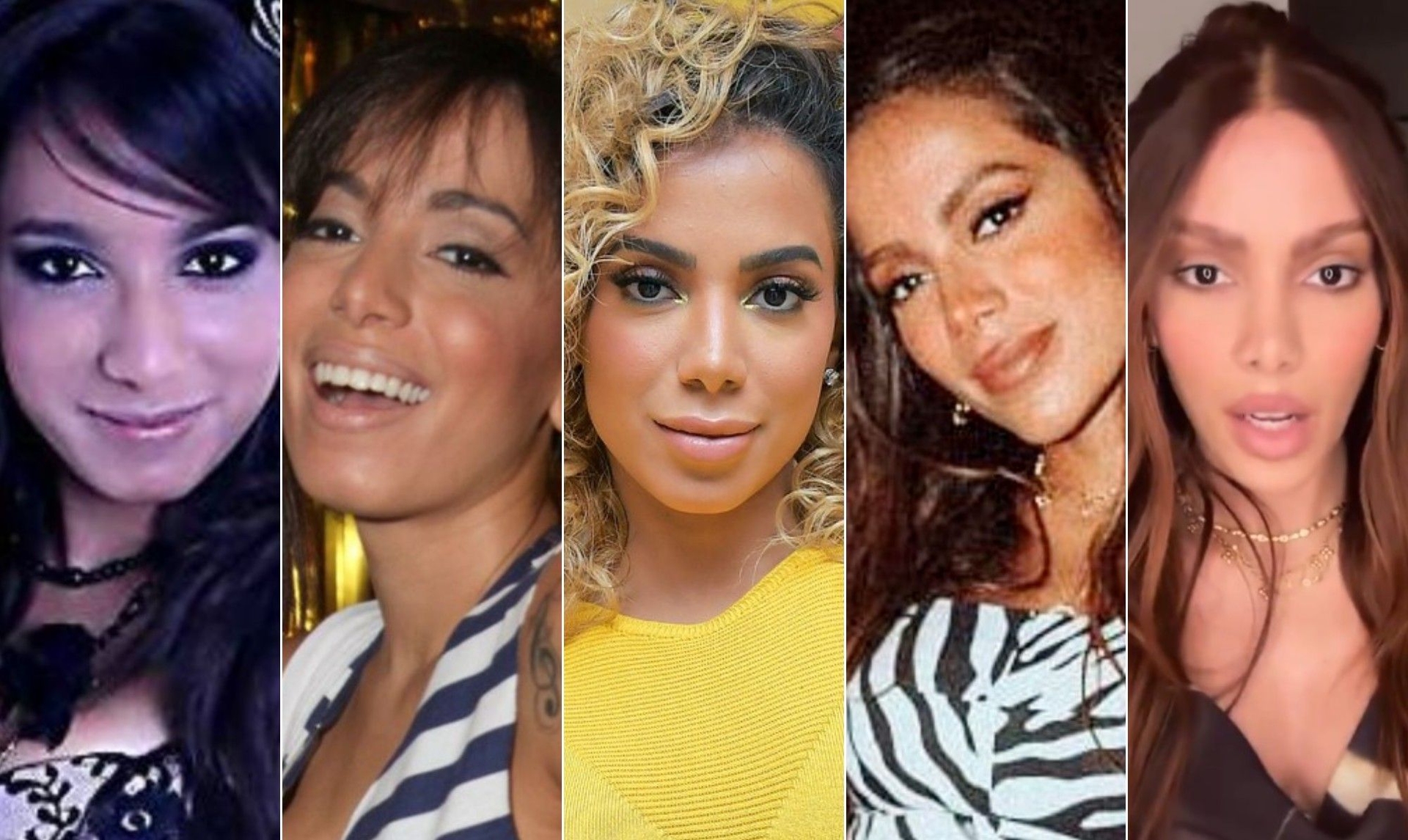 Anitta mostra novo visual após mais procedimentos estéticos, surpreendendo seguidores nas redes sociais. Reprodução: Globo