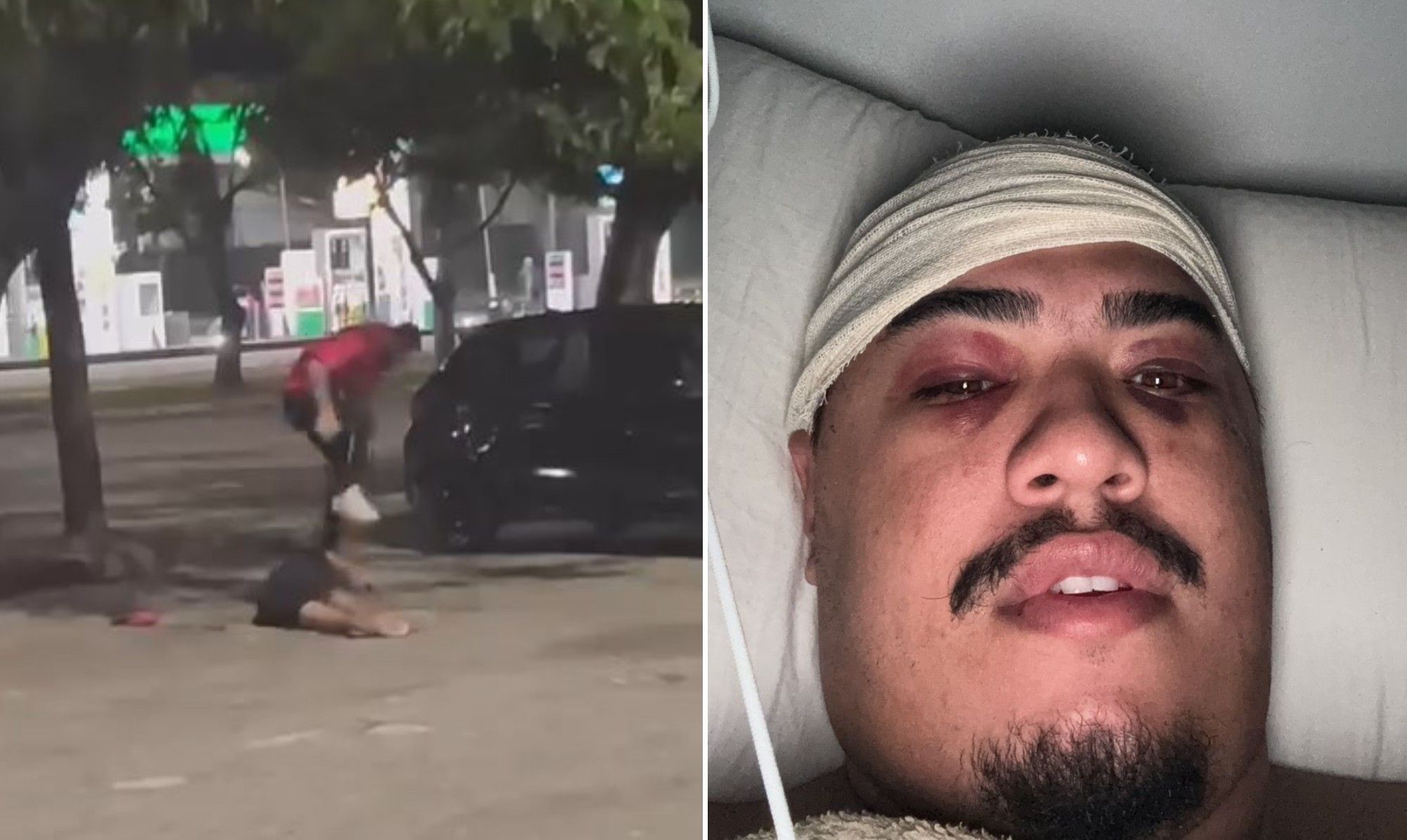 Pedro Jordão relata momentos de terror e luta por justiça após agressão brutal na Lagoa.; Reprodução: GLOBO