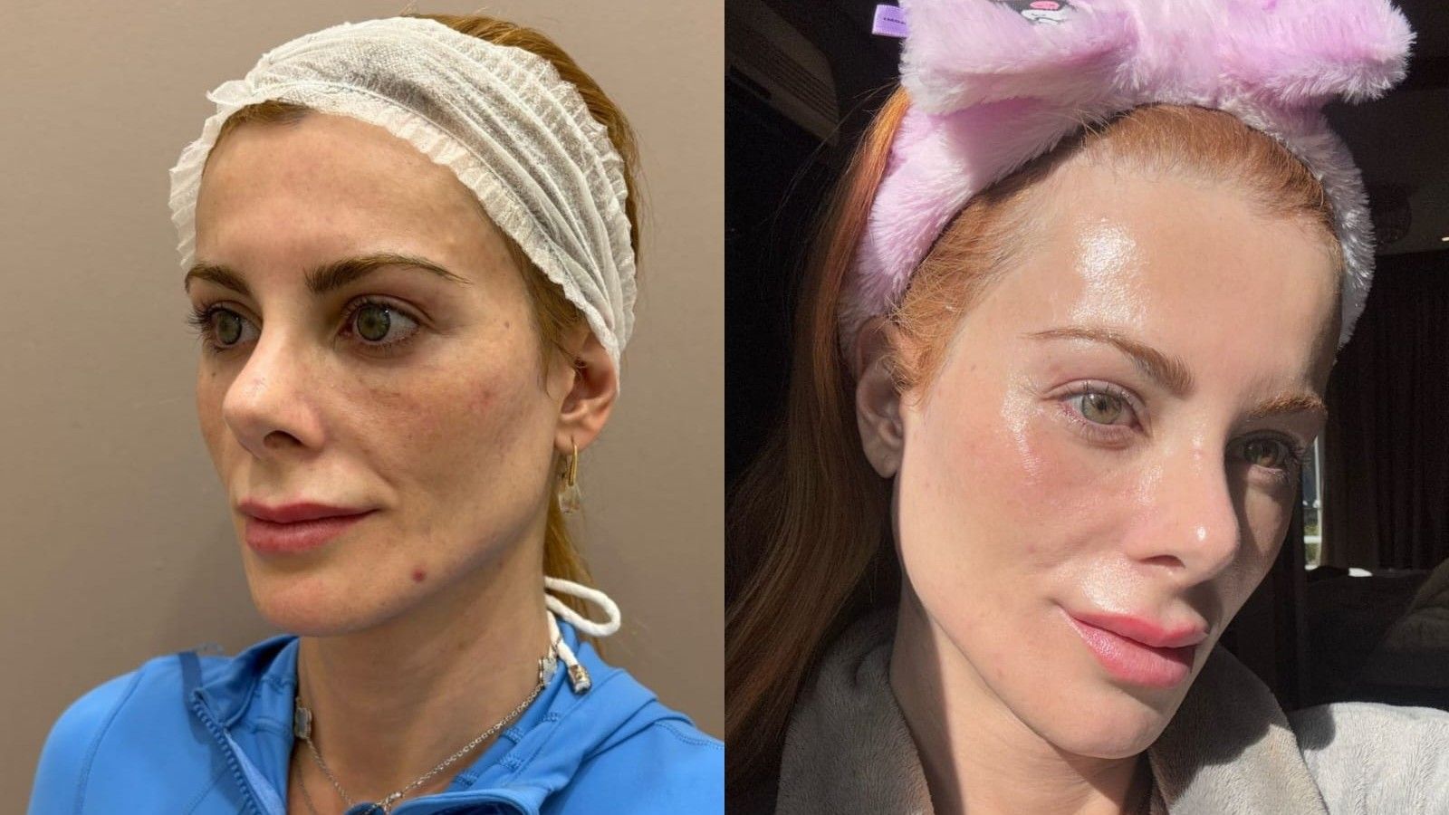 Deborah Albuquerque compartilha sua rotina de cuidados com a pele inspirada em tratamentos coreanos. Reprodução: Globo