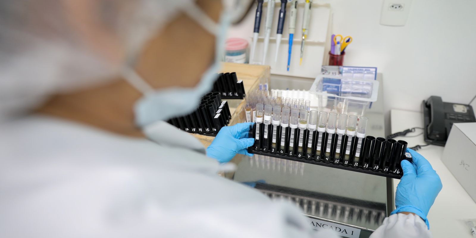 Fiocruz obtém patente para tratamento contra malária resistente - Foto: EBC