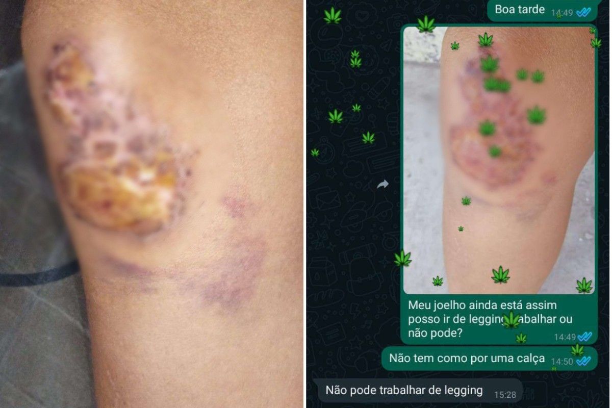 Justiça condena mercado por não permitir calça legging