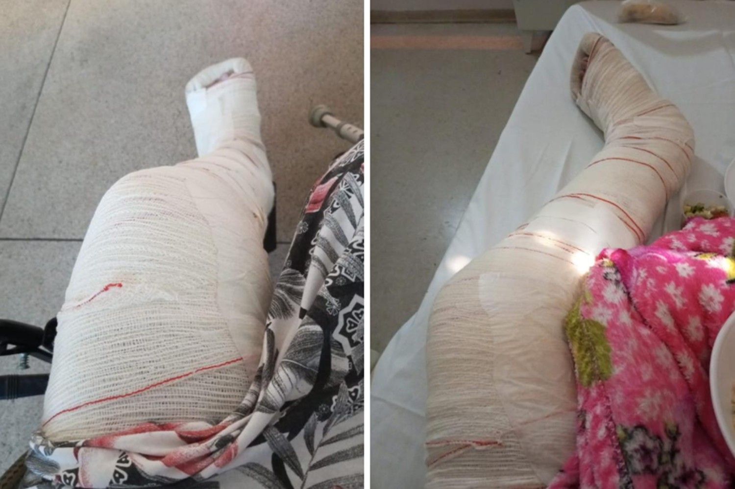 Mulher relata agressões sofridas em relacionamento violento em Palmas. Reprodução: Globo