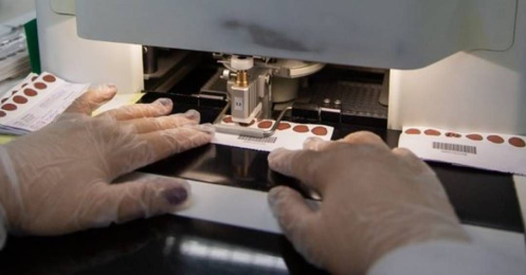 Ministério da Saúde anuncia contrato com os Correios para agilizar entrega do teste do pezinho. Reprodução: VEJA