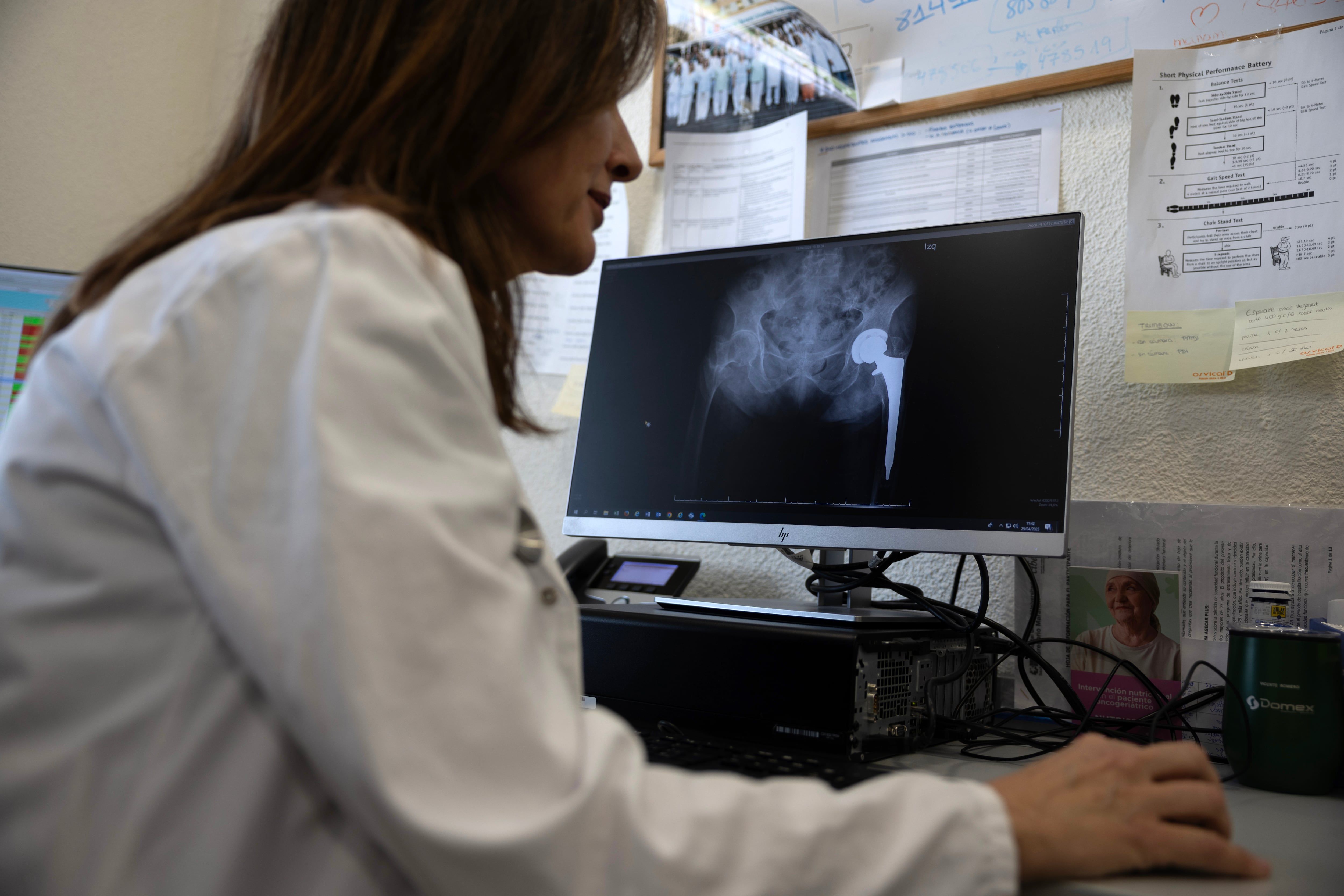 Acesso aos laudos radiológicos depende do hospital em Madrid. Reprodução: Elpais