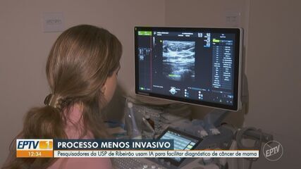 Pesquisadores da USP de Ribeirão Preto desenvolvem IA para aprimorar diagnóstico de câncer de mama. Reprodução: Globo.