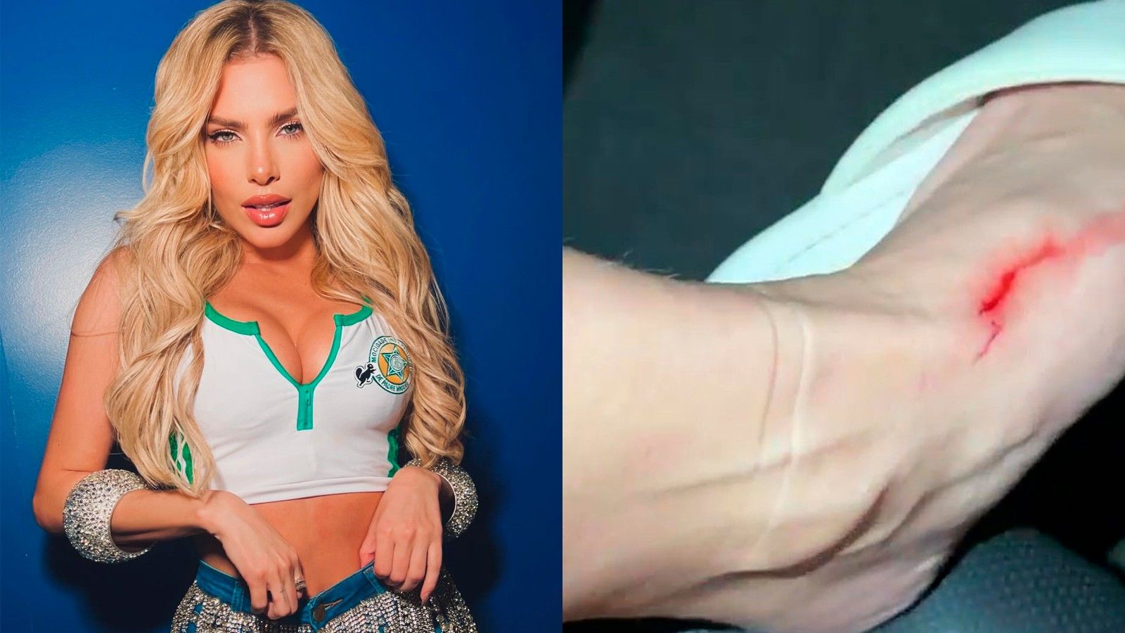 Erika Schneider, musa da Mocidade, corta o pé após ensaio de rua.. Reprodução: Gshow