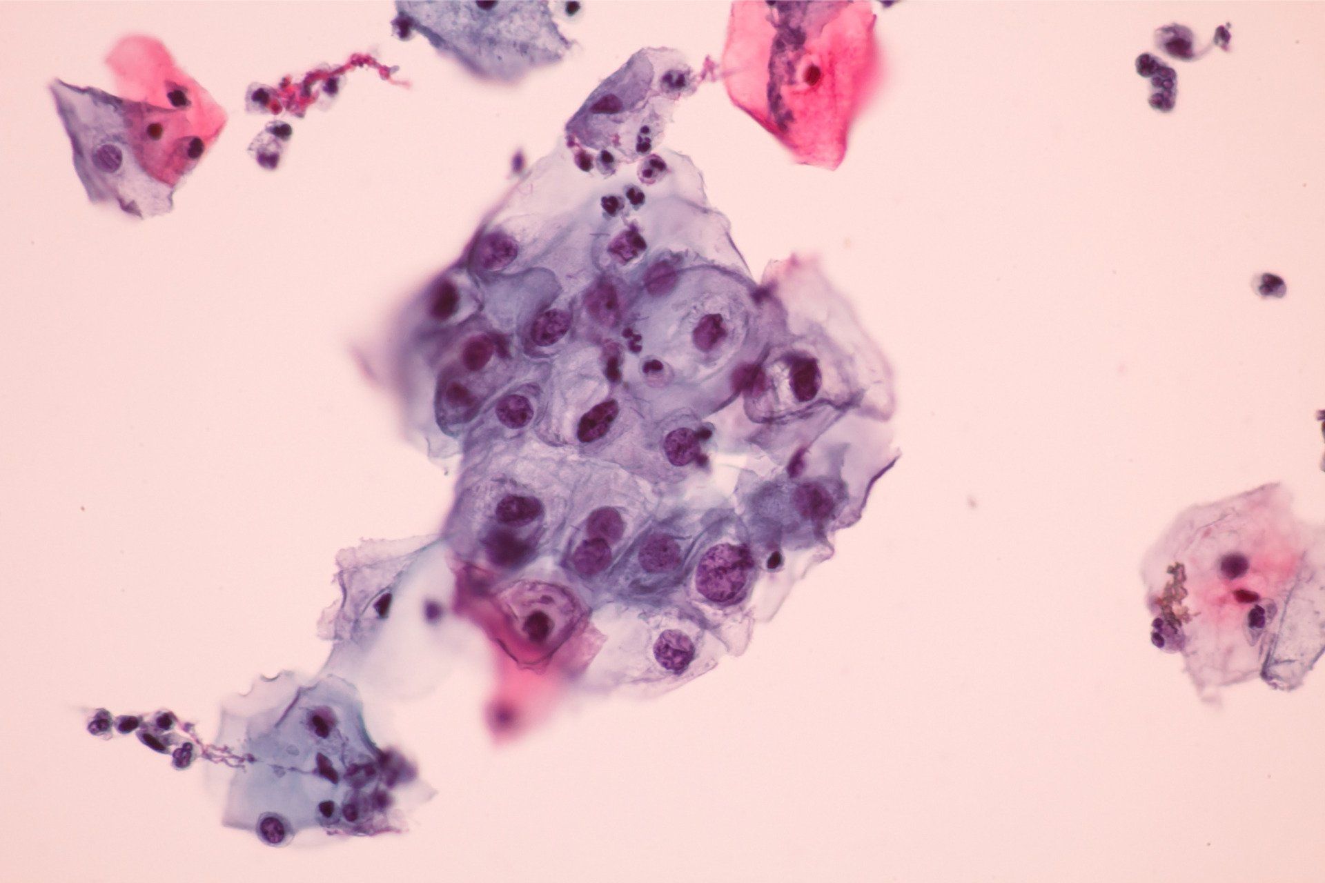 Terceiro da população desconhece a existência do HPV, segundo um novo estudo. Reprodução: Gizmodo