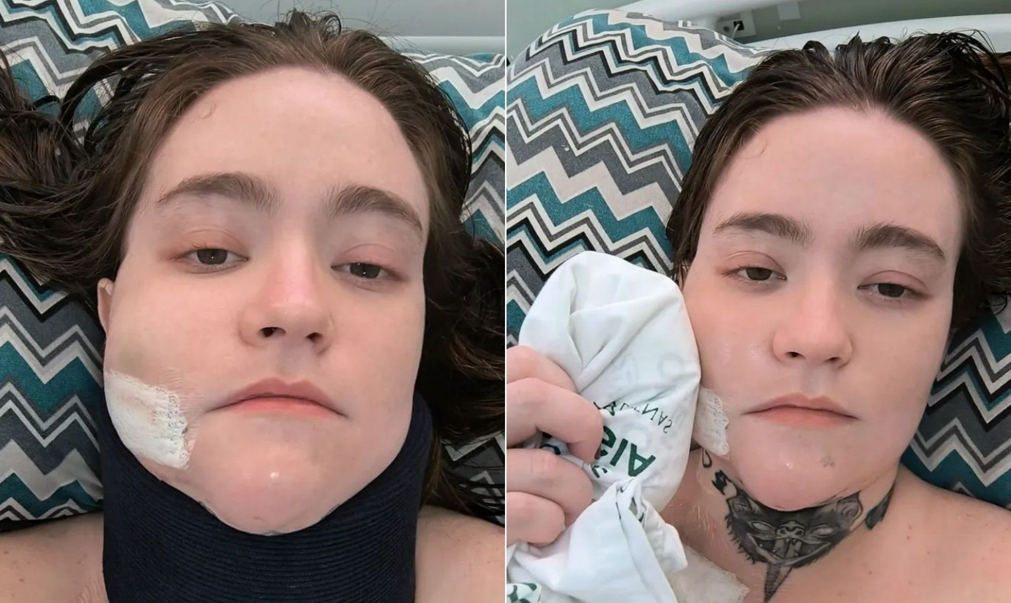 Carolina Arruda se prepara para sedação profunda e aplica cetamina após seis cirurgias sem sucesso. Reprodução: Globo