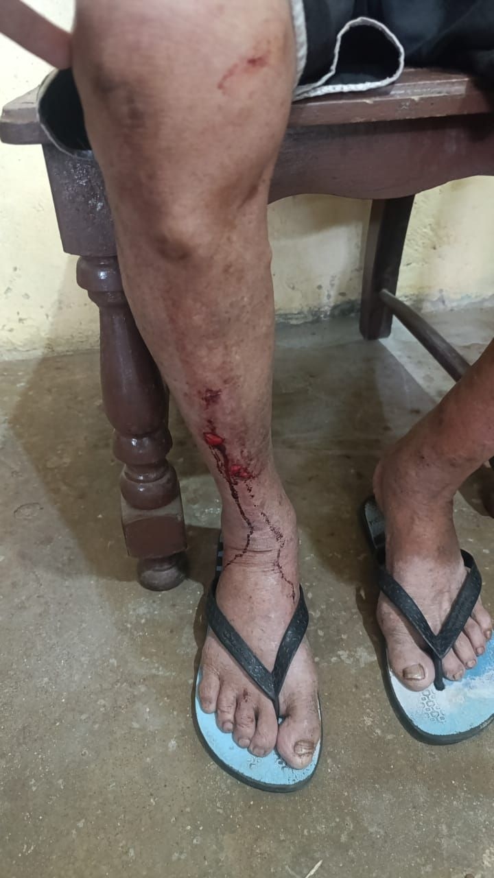 Idoso é agredido durante invasão em sua casa em Arapiraca. Reprodução: Redação