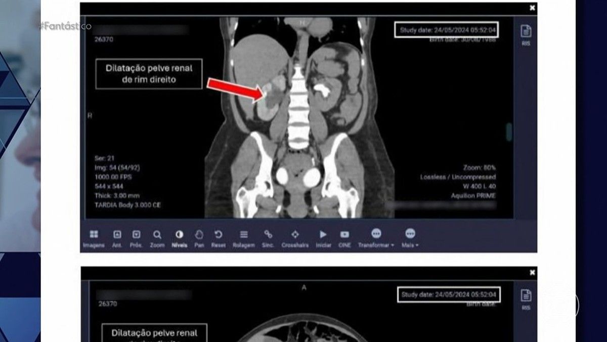 Médica obstetra tem registro suspenso por denúncias no Rio de Janeiro. Reprodução: Globo