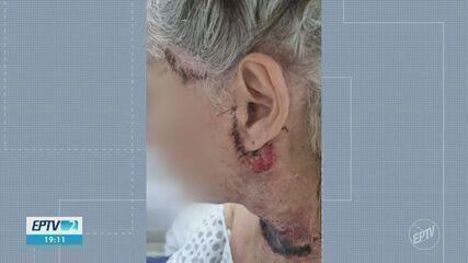 Influencer Carol da Mata se pronuncia sobre a saúde da mãe após complicações de procedimento estético. Reprodução: EPTV