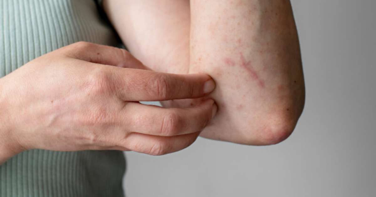 Coceira como Sinal de Alerta para Saúde