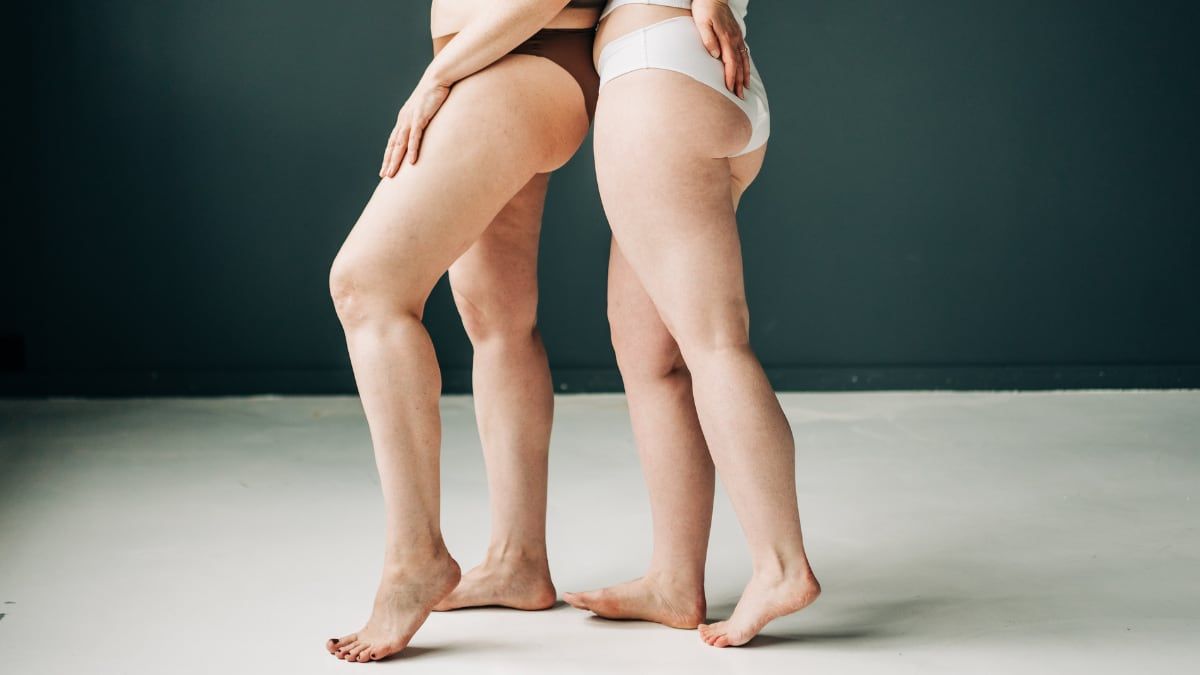 Bandas lisas ajudam a evitar atrito e assaduras nas coxas.. Reprodução: Elpais