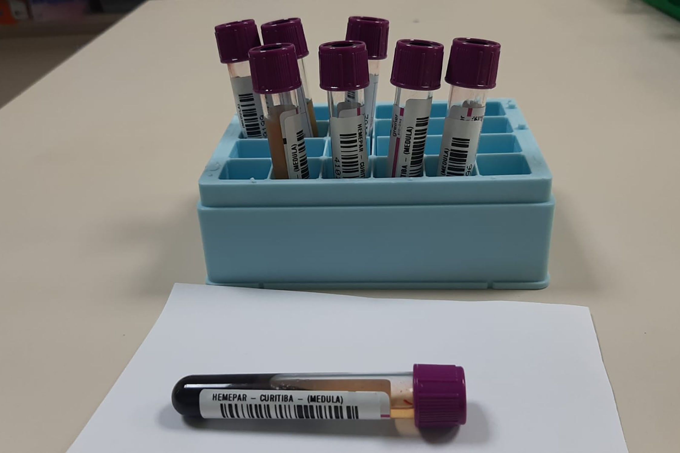 Pacientes aguardam transplante de medula no DF.. Reprodução: G1