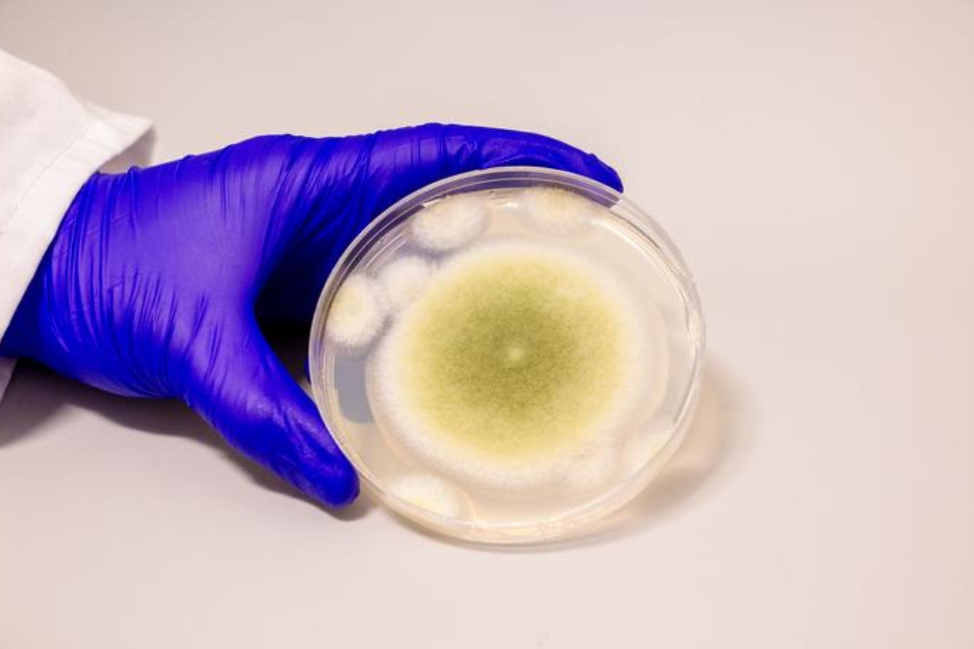 Fungo Aspergillus flavus é reconstituído como tratamento para leucemia.; Reprodução: Gizmodo