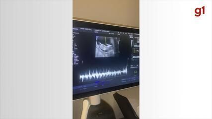 Carmelina, de 62 anos, espera sua sexta filha, Miriã, em Itapetininga, após fertilização in vitro. Legenda da imagem. Reprodução: Globo