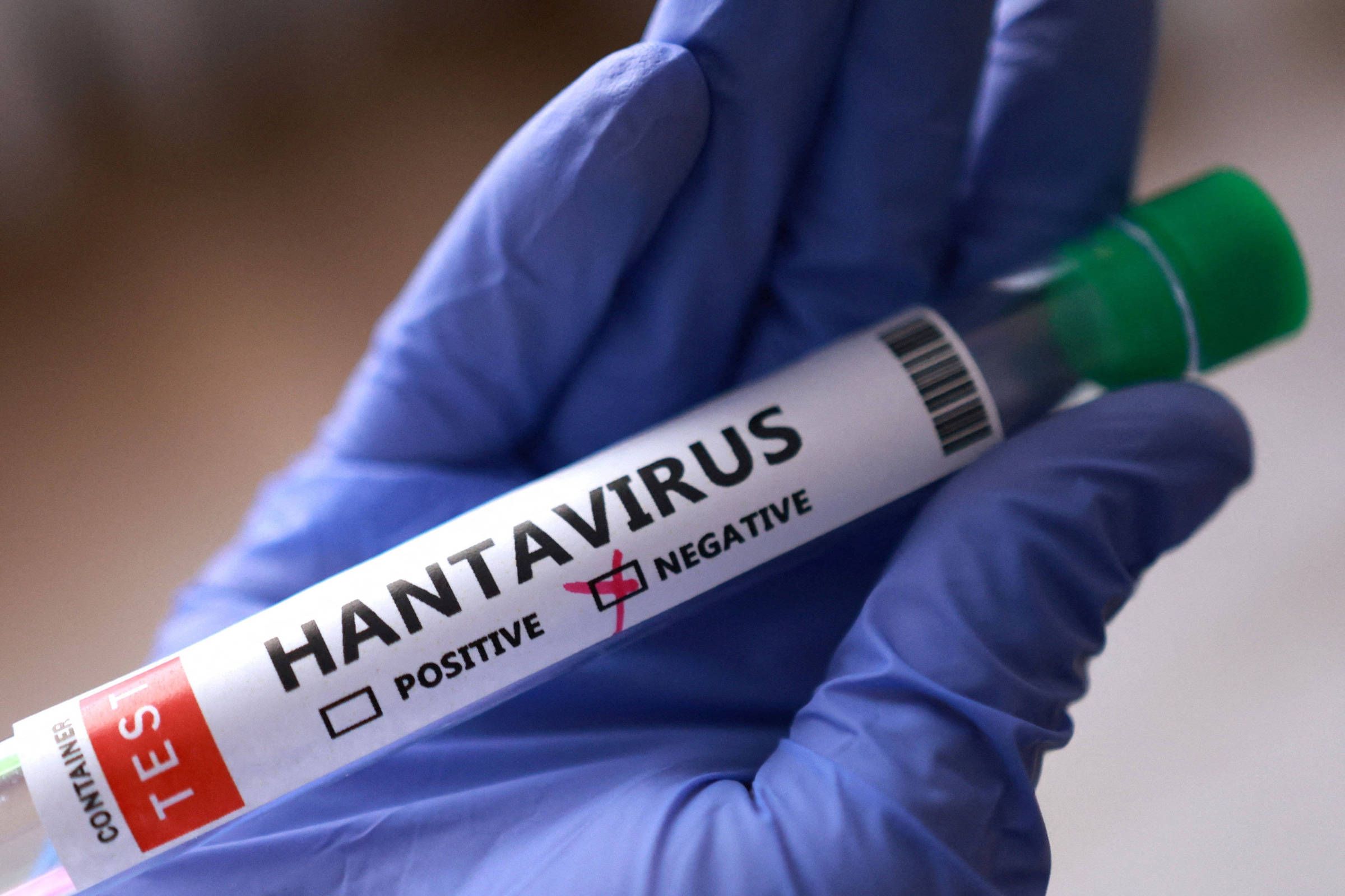 Surto de hantav�rus em navio tem casos suspeitos em 5 pa�ses; 3 pacientes s�o internados na Europa. Fonte: Folha de S.Paulo
