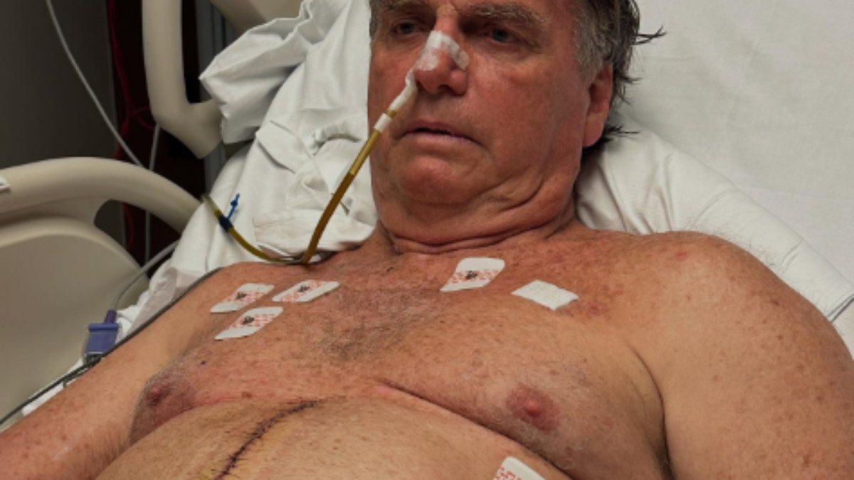 Ex-presidente segue sob cuidados médicos, recebendo nutrição venosa. Reprodução: iG.