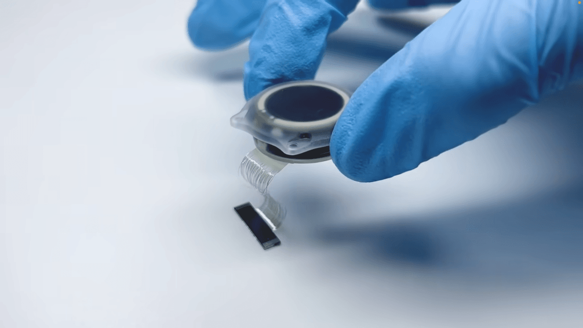 Neuralink: Avanços do chip cerebral em um ano de uso