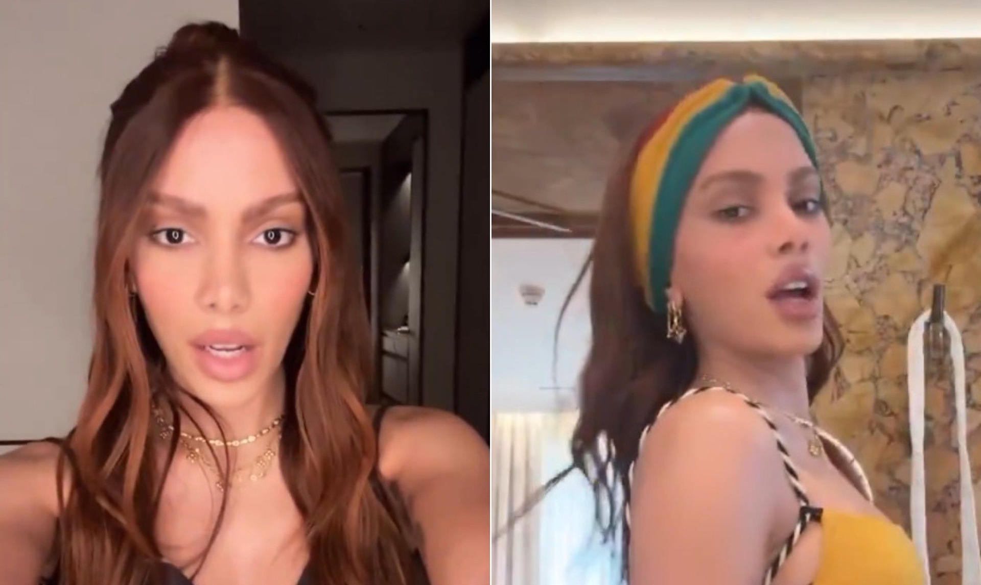 Anitta revela novos procedimentos estéticos após infecção, surpreendendo fãs com mudanças faciais. Reprodução: Globo