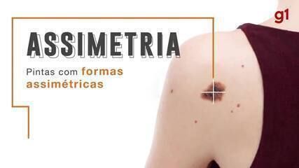 Centro de Oncologia Campinas realiza exames gratuitos para diagnóstico de câncer de pele. Reprodução: Globo