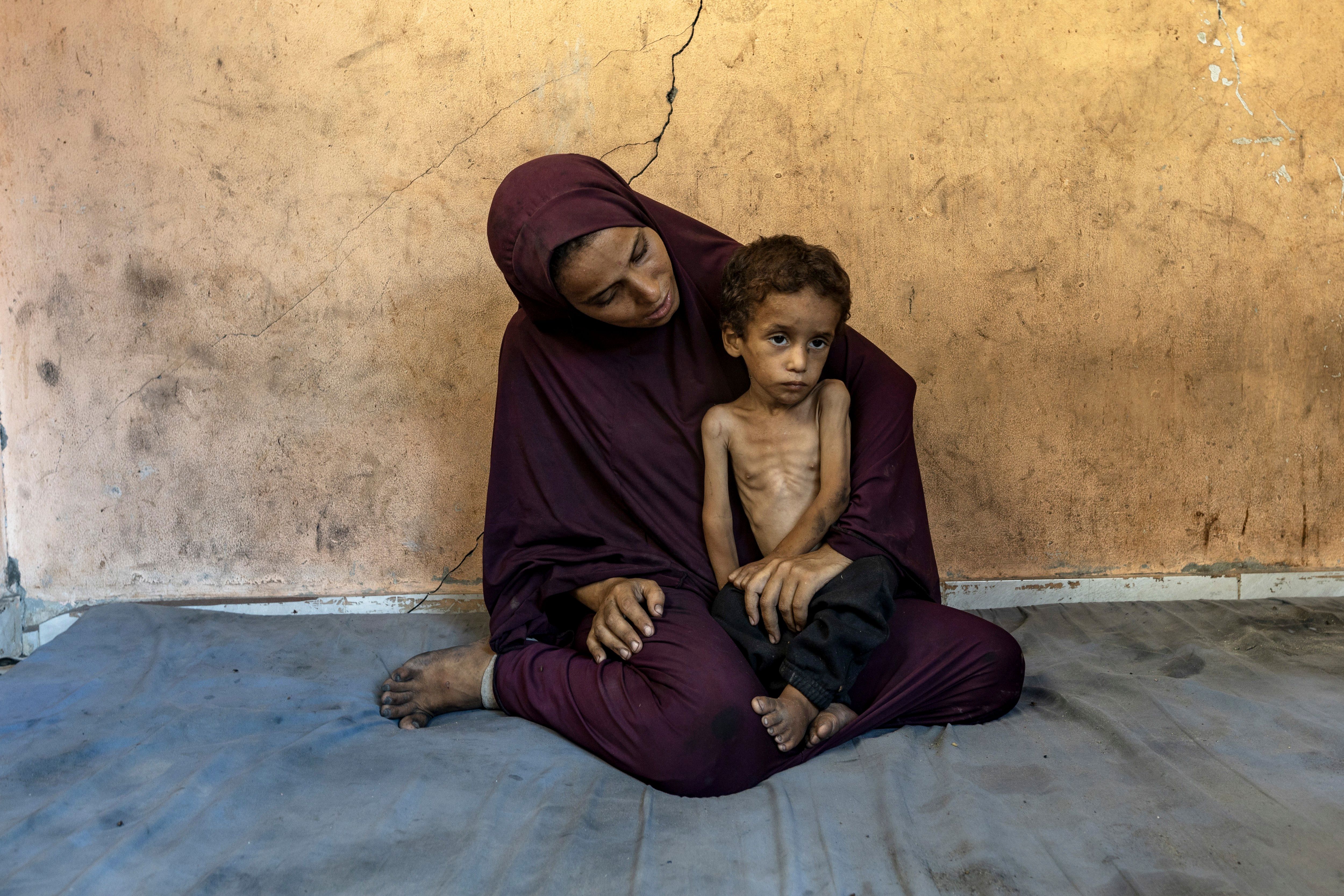 Crianças palestinas enfrentam grave desnutrição em meio à crise alimentar em Gaza. Reprodução: Globo