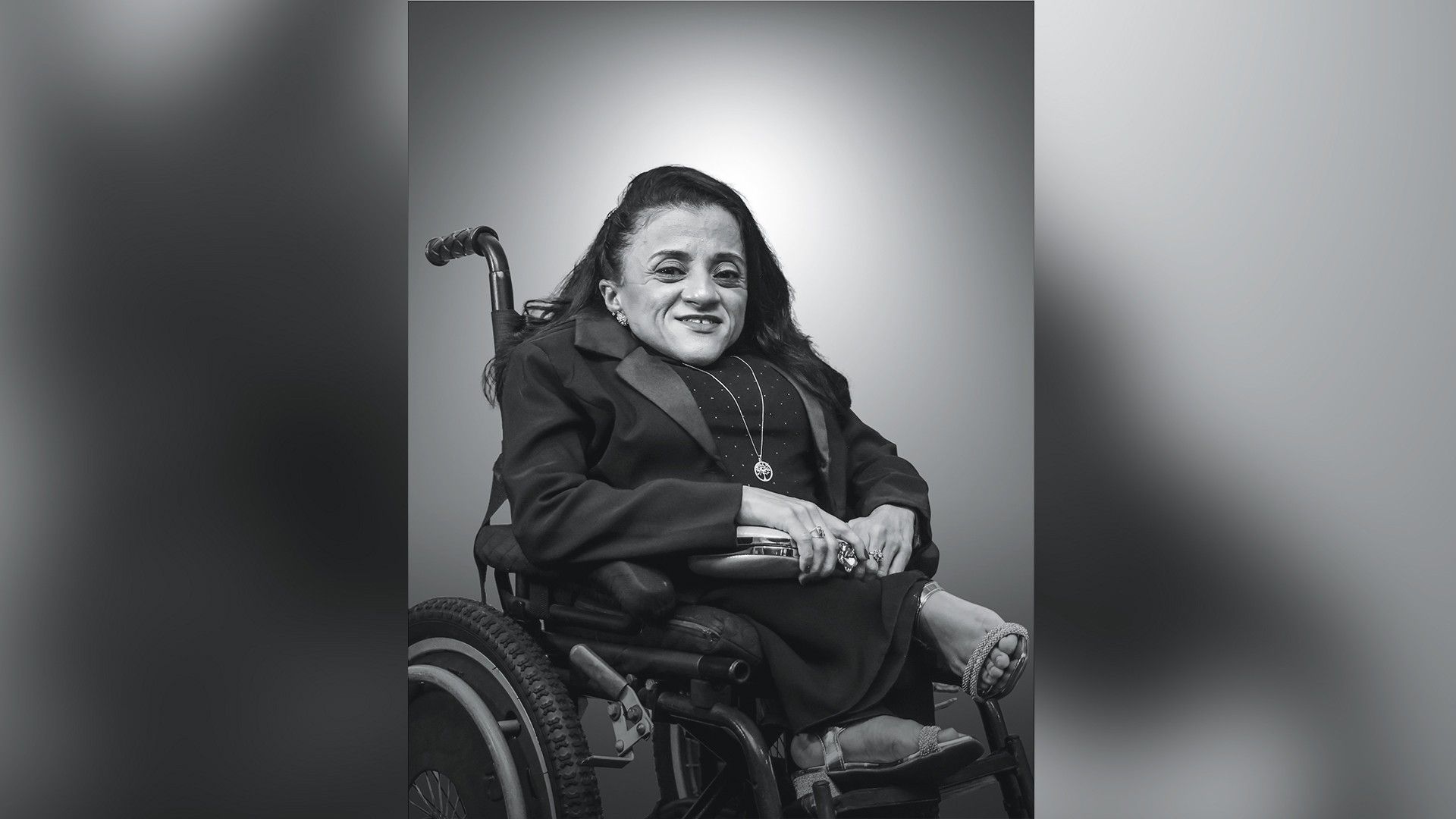 A história de Thais Pessanha: superação e inclusão na luta contra a osteogênese imperfeita