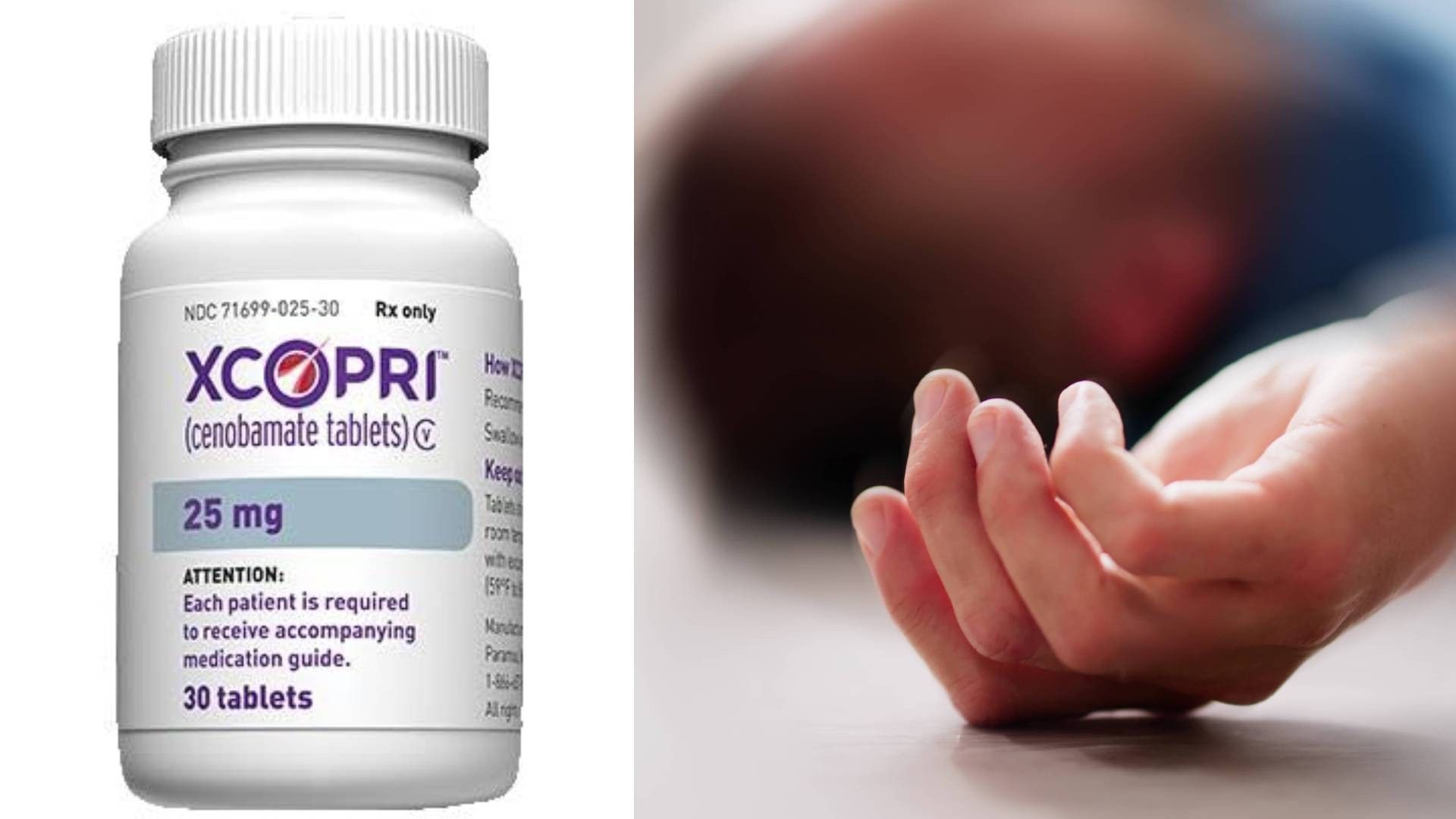 Tratamento aprovado para epilepsia promete reduzir crises graves, diz médico.. Reprodução: G1