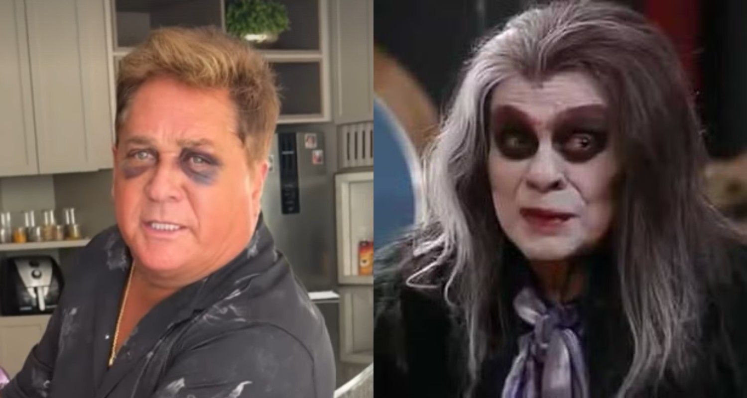 Leonardo faz piada sobre olho roxo após acidente. Reprodução: Gshow