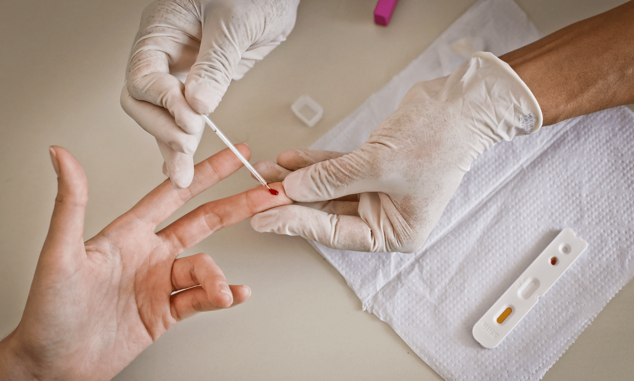 Brasil tem avanços na resposta ao HIV, mas enfrenta aumento nos casos da infecção, aponta Unaids