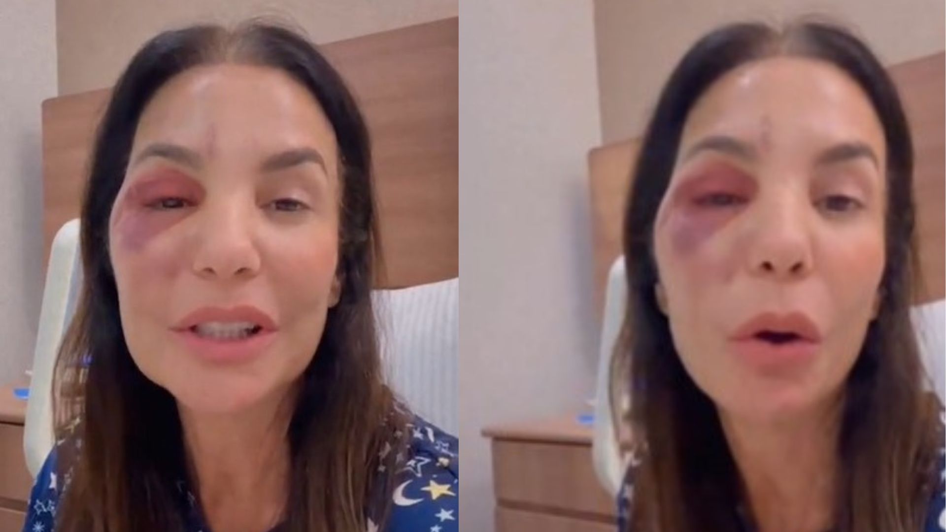 Ivete Sangalo recebe apoio de famosos na recuperação de cirurgia. Reprodução: Gshow