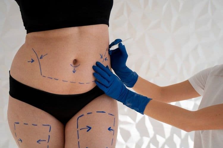 Empresária Natália Cavanellas Thomazella faleceu após complicações em cirurgia estética em São Paulo.; Reprodução: Globo
