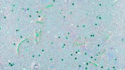 Estudo revela presença de microplásticos no cérebro humano