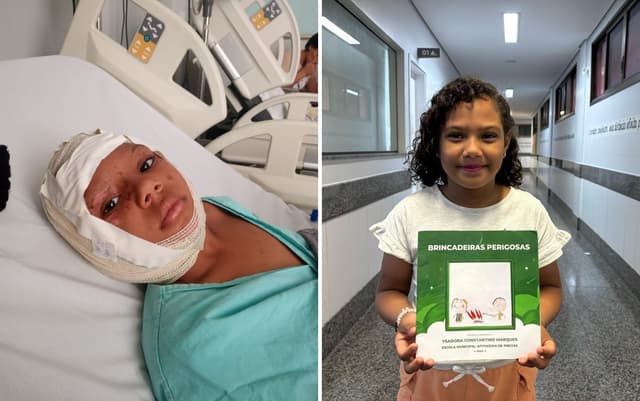 Ysadora Marques, de 8 anos, viveu um acidente com fogo enquanto brincava em Jaraguá. Legenda da imagem. Reprodução: Globo
