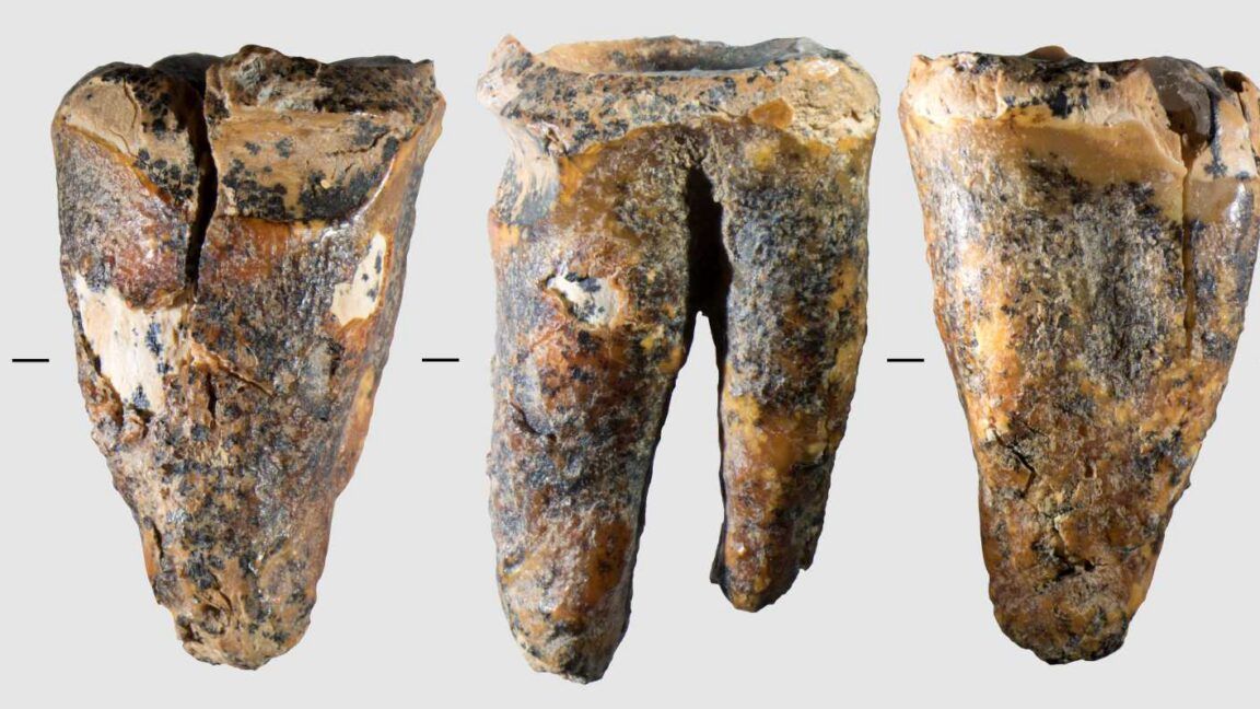 Neanderthals drilled cavities to treat a toothache 59,000 years ago - Foto: Ars Technica