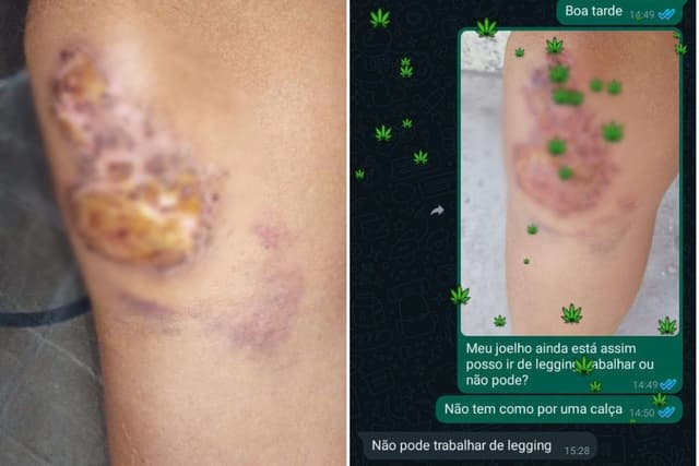 Justiça condena mercado por não permitir calça legging