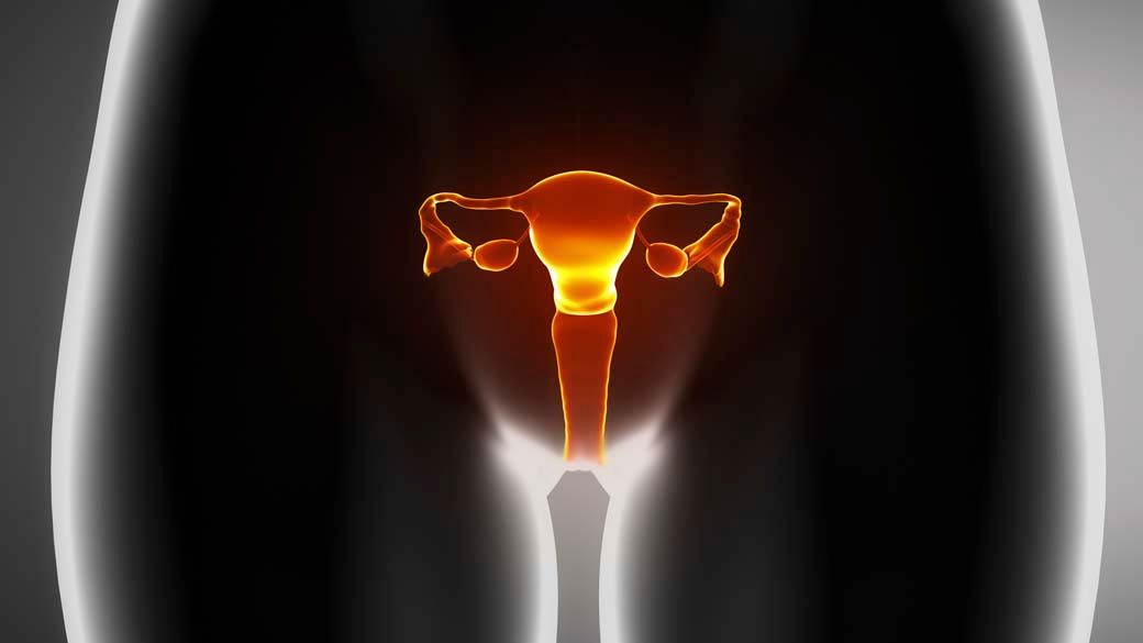 Por que uma doença que afeta mais de 170 milhões de mulheres vai mudar de nome - Foto: VEJA