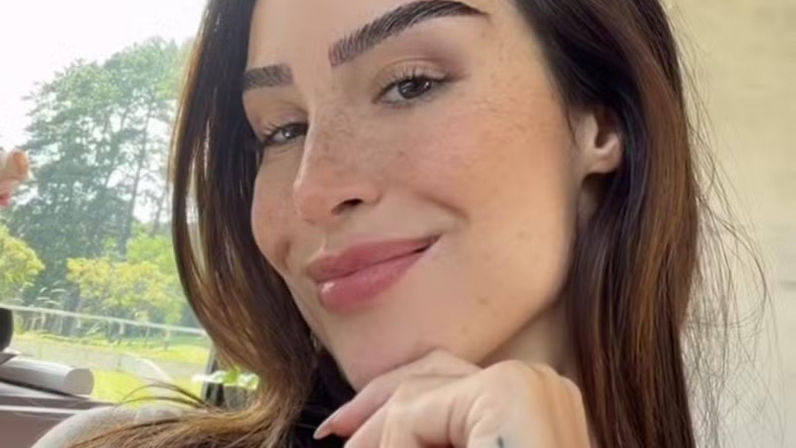 Influenciadora exibe transformação com transplante de sobrancelhas.. Reprodução: Oglobo