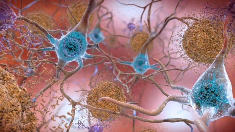 Medicamentos para diabetes podem ajudar no Alzheimer