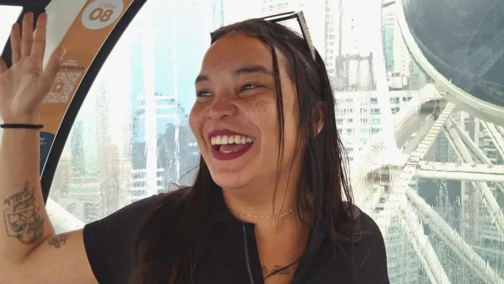 Vítima Renata, em São Sebastião, com trauma cranioencefálico após acidente.. Reprodução: G1