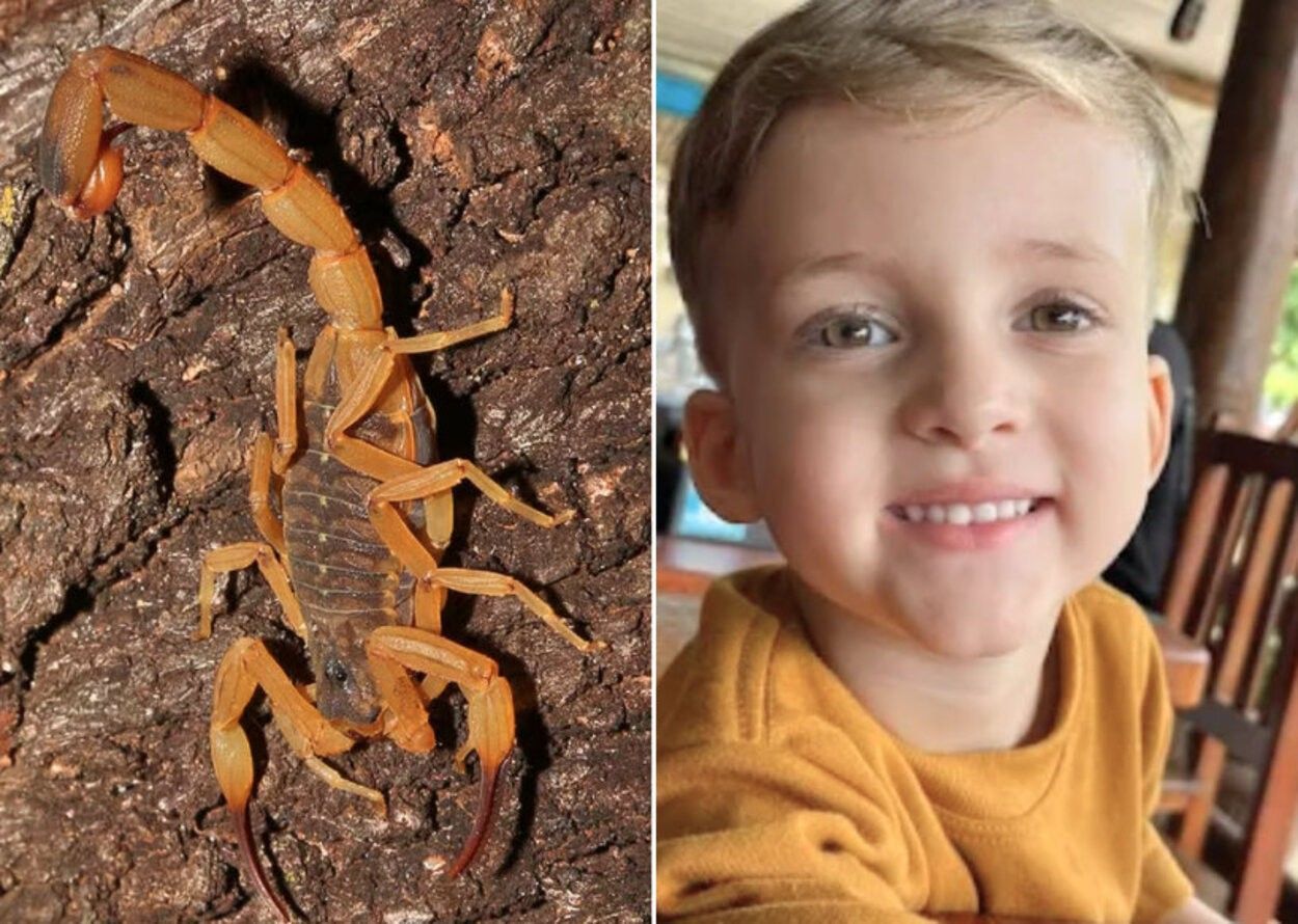 Menino em hospital após ataque de escorpião, soro administrado 4 horas depois.. Reprodução: G1