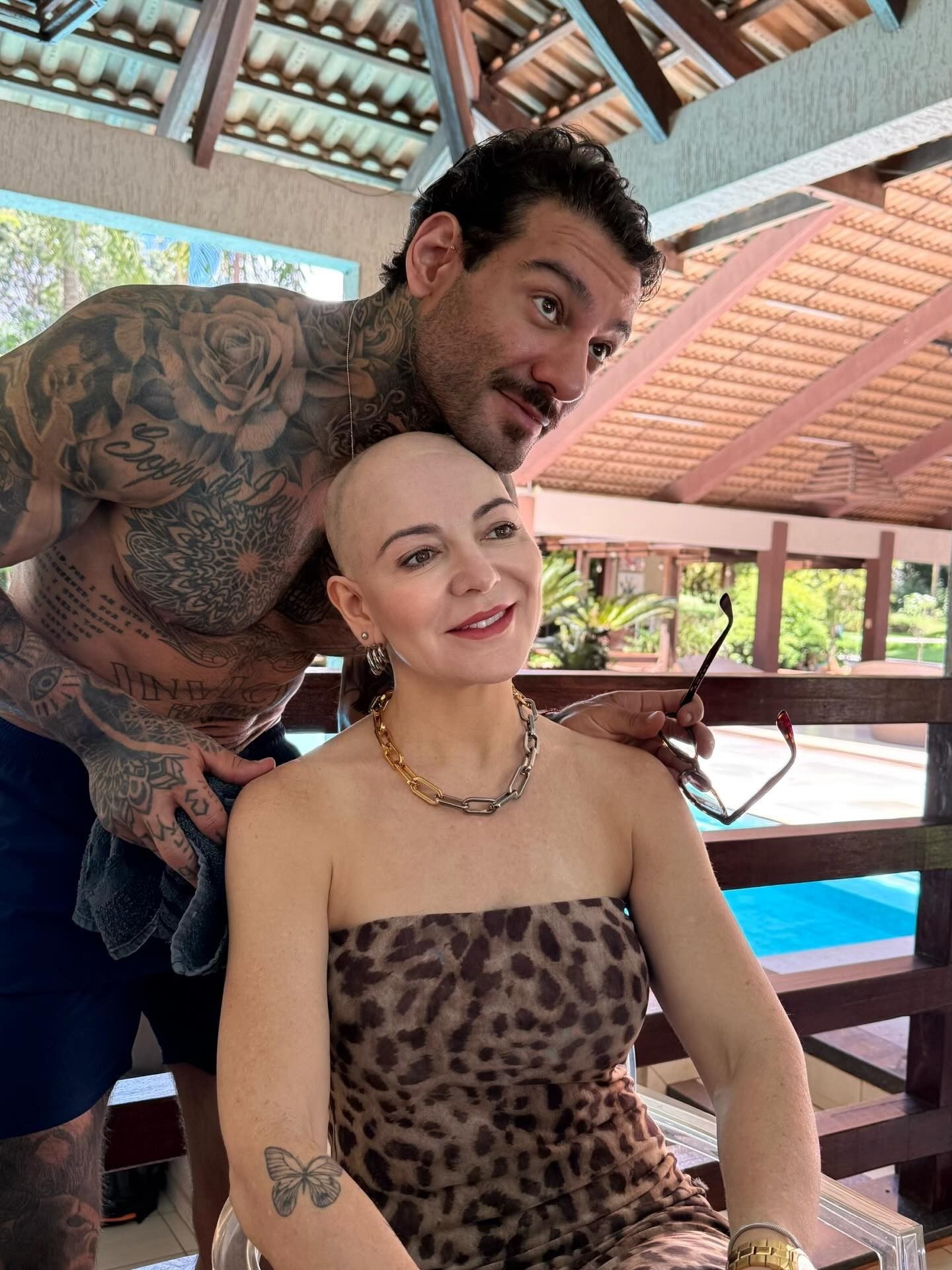 [Mãe de Lucas Lucco: mensagens recebidas após alopecia areata, não é sobre estética.]. Reprodução: Gshow