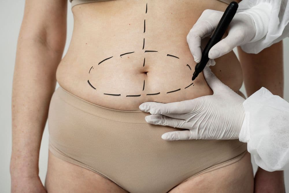 A cirurgia de pálpebras é o procedimento mais procurado em 2024, segundo a ISAPS.; Reprodução: Globo