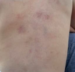 Mãe denuncia a Apae por agressão à filha autista de 5 anos no interior de MG.. Reprodução: G1