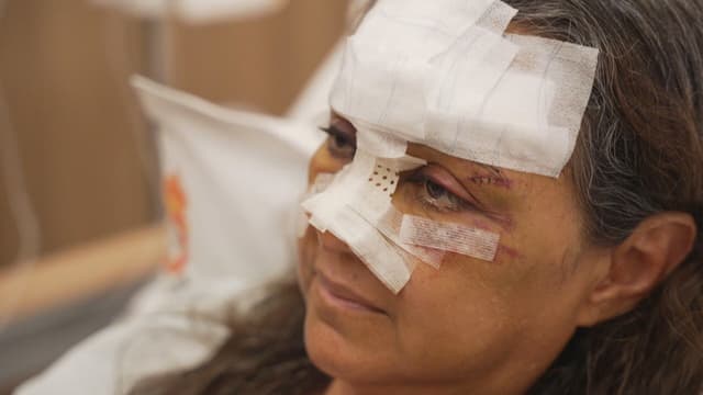 [Mulher com câncer relata agressão pelo ex-secretário de Calumbi]. Reprodução: G1