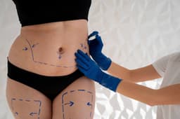 Empresária Natália Cavanellas Thomazella faleceu após complicações em cirurgia estética em São Paulo.; Reprodução: Globo