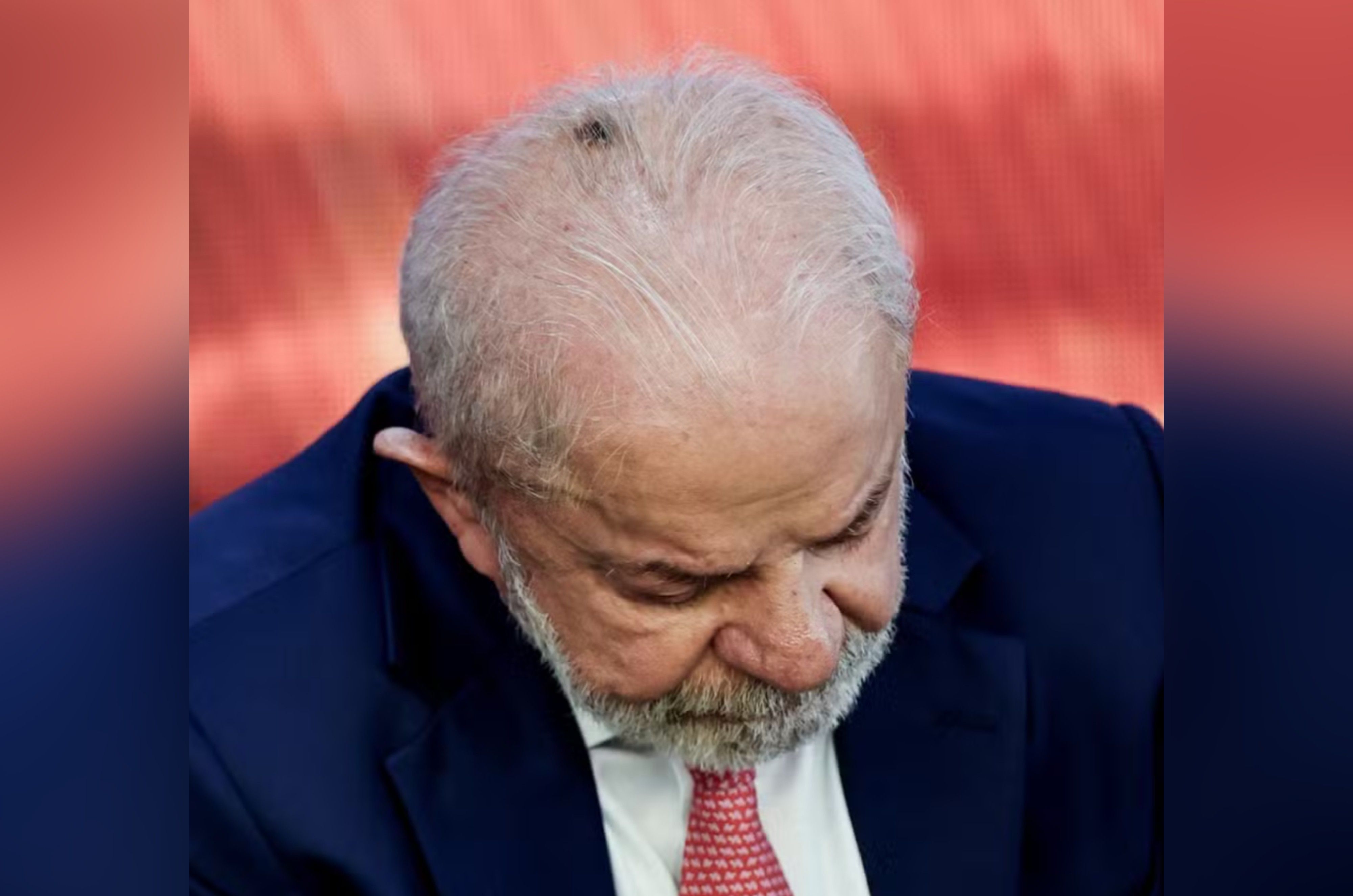 Lula, no Sírio-Libanês, passa por procedimentos nesta sexta.. Reprodução: G1
