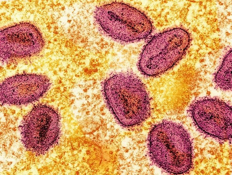 Brasil registra primeiro caso da nova cepa de mpox